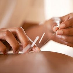 user provided Camellia City Acupuncture photo