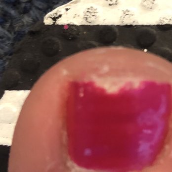 Jolie Nail Spa - Chipped toe nail paint 1.5 days after pedicure - Nail Salons Near Me - Irving, Texas