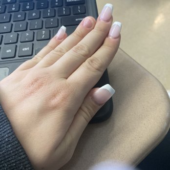 Eden Nails - Fallen off nail - Nail Salons Near Me - Aberdeen Township, New Jersey