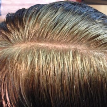 Head Lice Camouflaging To Hair Color Yelp