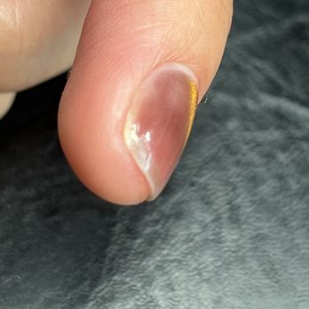 Alejandra Dream Nails - this is not lifting this is just an unpolished area - Nail Salons Near Me - Whittier, California