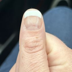VIP Nails & Spa - This nail was so long and now it's a stubbed toe