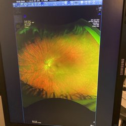 Emily Eye Care - Eye photo