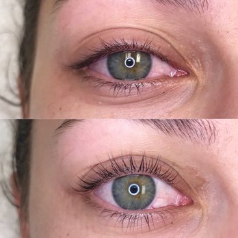 Skinfinity - Hair Removal Near Me - Irvine, California