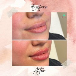 Quenby's Aesthetics & Wellness - Gorgeous lips by the talented Layla, RN
