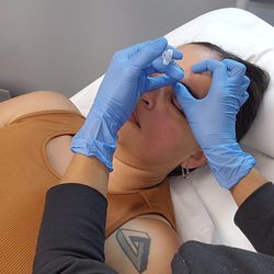 Koco Medical Aesthetics - Botox! Angry 11's