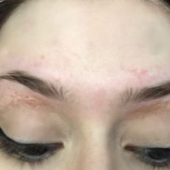 Lakeview Threading Salon - Cuts/nicks on both brows, very irritated skin from being too rough, and the brows themselves are too thin. - Skin Care Near Me - Chicago, Illinois