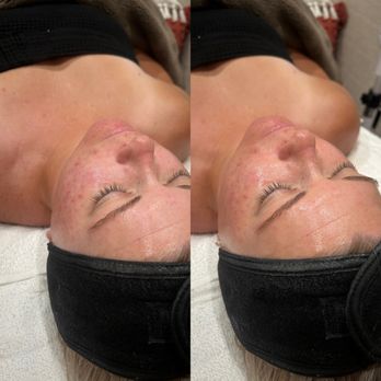 Fresh Faces By Jamesyn - Estheticians Near Me - Murrieta, California Fresh Faces By Jamesyn - Estheticians Near Me - Murrieta, California