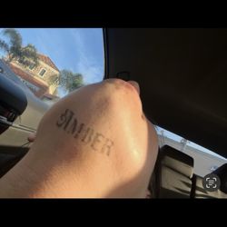 Laser Fresh Aesthetics - After 2 sessions
