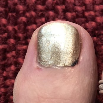 Camelback Nail Bar - One day later... He injured the whole cuticle and left me with a big gross scab. I paid for this? - Nail Salons Near Me - Phoenix, Arizona
