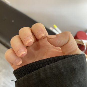 Queen Anne Nails & Spa - After 5 days -- this is less than a week. - Nail Salons Near Me - Seattle, Washington