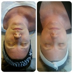 Inner Beauty Esthetics - Micro Current Face Lift Therapy