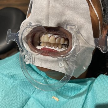 Buckhead Dental Center - General Dentistry Near Me - Atlanta, Georgia