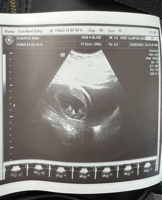 First Glimpse Imaging