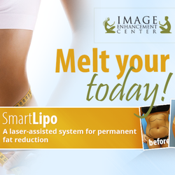 The Image Enhancement Center - SmartLipo - Laser Liposuction