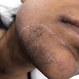 Rejuva Laser Hair Clinic 2019 All You Need To Know Before You Go