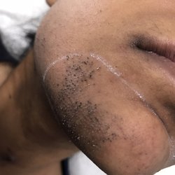 Rejuva Laser Hair Clinic 2019 All You Need To Know Before You Go