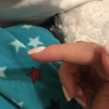 Jade Nails & Spa - Raised acrylic due to excessive dipping - Nail Salons Near Me - Miami, Florida