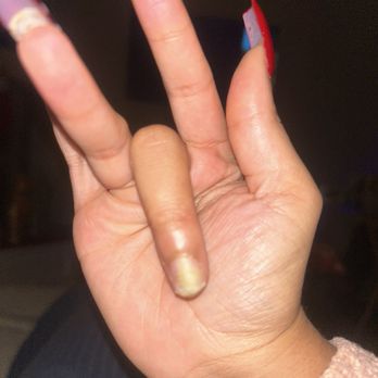 MH Gel Nails Beauty - Infection - Nail Salons Near Me - Long Beach, California