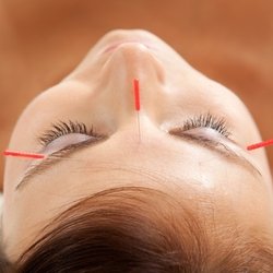 Cosmetic rejuvenation acupuncture at RareBird Acupuncture