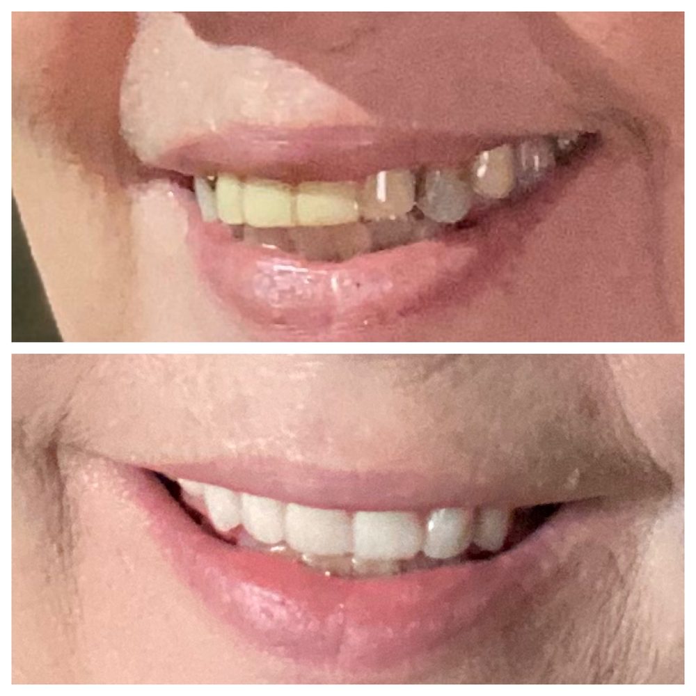 EXTRACTION AND DENTURE CENTER 10 Photos & 41 Reviews 251 E Michigan