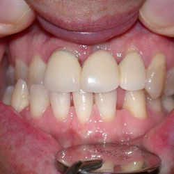 Ross H Dixon, DDS - Before