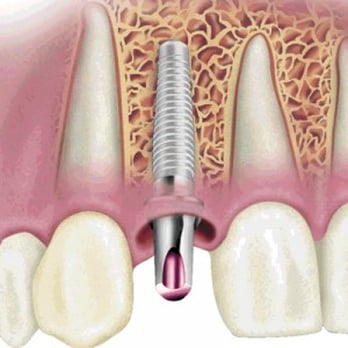Ana R Ortiz, DDS - Implant Dentistry - Oral Surgeons Near Me Ana R Ortiz, DDS - Implant Dentistry - Oral Surgeons Near Me