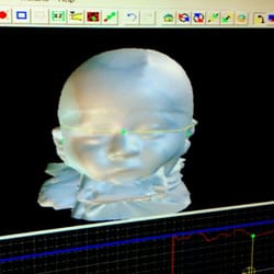 Hanger Clinic: Prosthetics & Orthotics - Computerized 4D laser scan of Rocco's cranium so awesome! Thank you Tiffany!