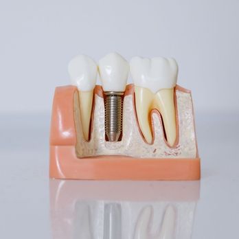 Cal Dental - Cosmetic Dentists Near Me - Van Nuys, California
