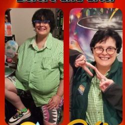 Arizona Pain & Spine Institute - Before&after top surgery w thanks to recs from Dr. Rykin, Dr. Cloonan, surgeon Dr Turin, all their medical pros