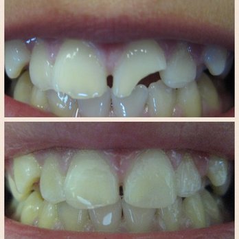 Samson Yang, DMD - General Dentistry Near Me - San Diego, California Samson Yang, DMD - General Dentistry Near Me - San Diego, California