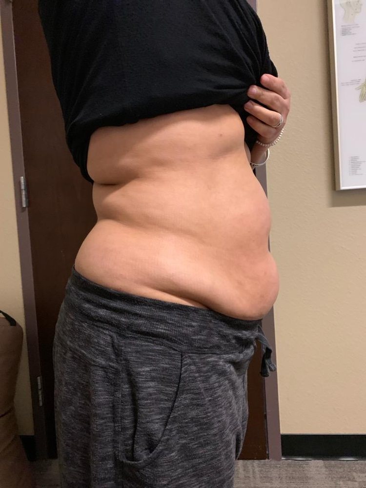 Advanced Body Sculpting Logo