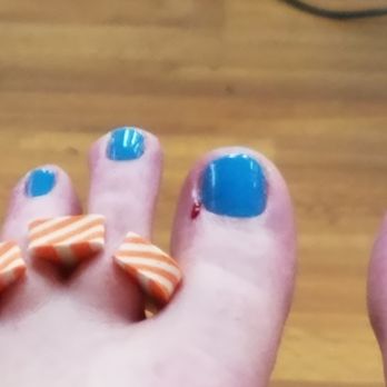 Artistic Nails Spa - My bleeding toe - Nail Salons Near Me - Lahaina, Hawaii