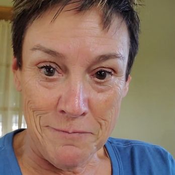 Advanced Healing Center - No surgical or extreme procedures but amazingly effective results. - Skin Care Near Me - Minneapolis , Minnesota Advanced Healing Center - No surgical or extreme procedures but amazingly effective results. - Skin Care Near Me - Minneapolis , Minnesota