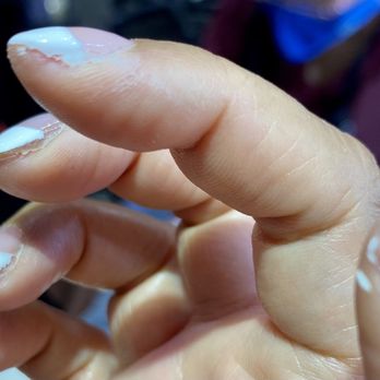 Happy Nails & Spa - Missing paint on edge of nails. - Skin Care Near Me - Irvine, California Happy Nails & Spa - Missing paint on edge of nails. - Skin Care Near Me - Irvine, California