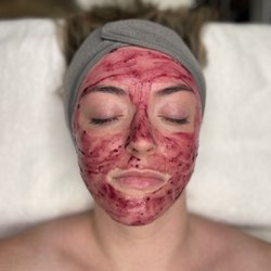 Vivid Skin Lab - Enzyme Facial
