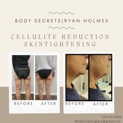 Body Secrets
