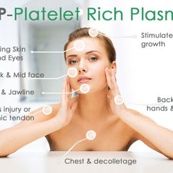 Dr. S, Naturopathic Doctor - PRP Therapy is used in hair growth, aesthetics, regenerative joint therapy, breast lifts, and sexual wellness!!!