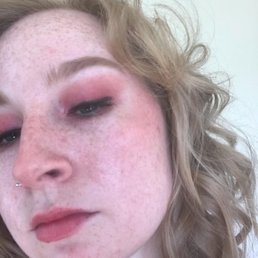 How my skin is now. There's the occasional acne spot,but it doesn't hurt, is small, and doesn't affect my confidence. Make up w/o foundation How my skin is now. There's the occasional acne spot,but it doesn't hurt, is small, and doesn't affect my confidence. Make up w/o foundation