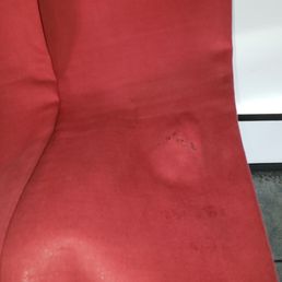 Burn damage