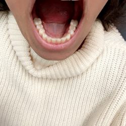 Lake Forest Dental Health Care - Work on my bottom last teeth crowns n fillings.
