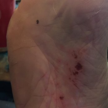 Posh Nails & Spa - This is what they did to the bottom of my husbands foot. - Waxing Near Me - Riverside, California Posh Nails & Spa - This is what they did to the bottom of my husbands foot. - Waxing Near Me - Riverside, California