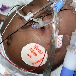 Children's Hospital of the King's Daughters - Dirty gtube site