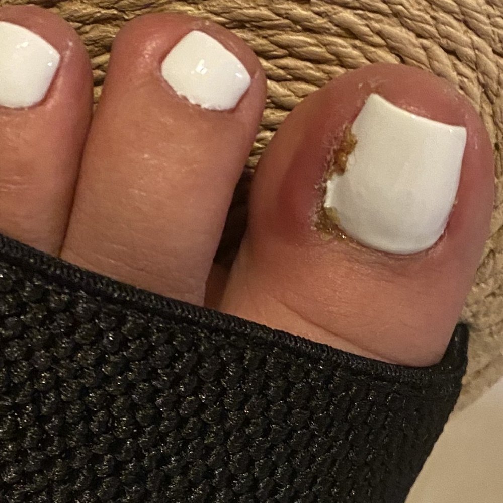 Nails Chateau - Both of my big toes are infected because of the overly aggressive pedicurists named Ky. - Nail Salons Near Me - Elk Grove, California Nails Chateau - Both of my big toes are infected because of the overly aggressive pedicurists named Ky. - Nail Salons Near Me - Elk Grove, California