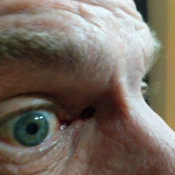 California Skin Institute Monterey 13 Photos 68 Reviews Skin Care 9781 Blue Larkspur Ln Monterey Ca Phone Number