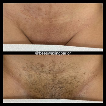 Bee Waxing Parlor - Before and after of a Brazilian wax. - Waxing Near Me - Colorado Springs, Colorado Bee Waxing Parlor - Before and after of a Brazilian wax. - Waxing Near Me - Colorado Springs, Colorado