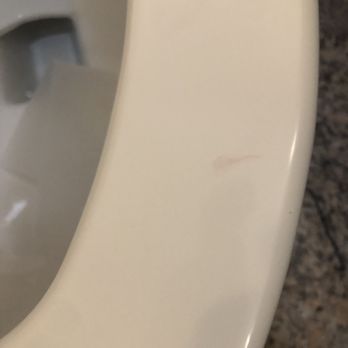 Days Inn by Wyndham Lanham Washington D.C - Stains on toilet - Hotels Near Me - Lanham, Maryland Days Inn by Wyndham Lanham Washington D.C - Stains on toilet - Hotels Near Me - Lanham, Maryland