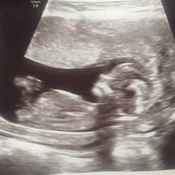 Incredible Journey Birth Services