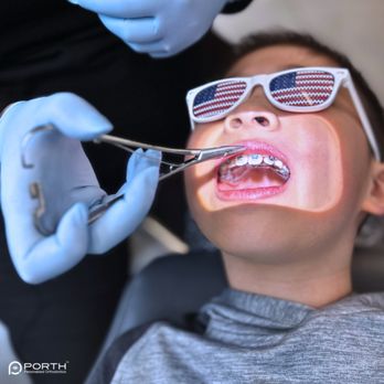 Personalized Orthodontics - orthodontic expander - Orthodontists Near Me - Bellevue, Washington Personalized Orthodontics - orthodontic expander - Orthodontists Near Me - Bellevue, Washington