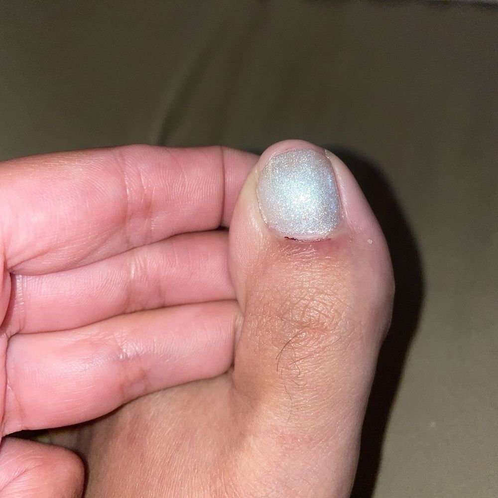 Pedicure disaster. Pedicure disaster.